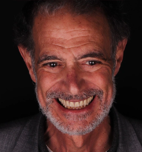 Img-before-and-after - AFTER 13