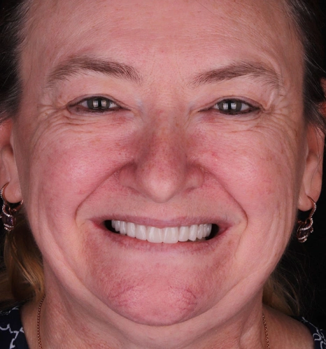 Img-before-and-after - AFTER 14