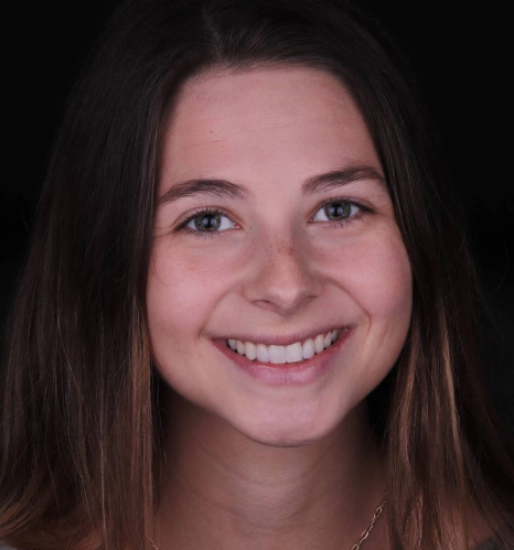 Img-before-and-after - AFTER 15