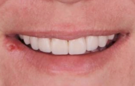 Img-before-and-after - AFTER 3