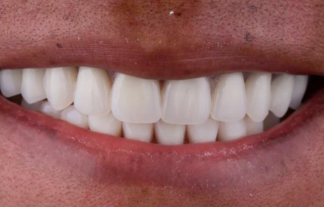 Img-before-and-after - AFTER 6