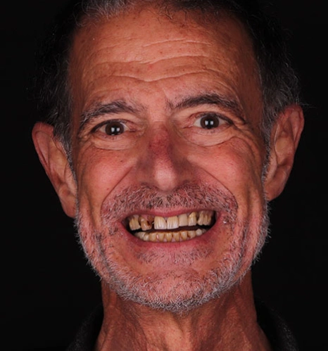 Img-before-and-after - AFTER 13