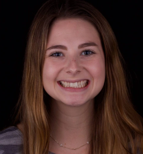 Img-before-and-after - BEFORE 15