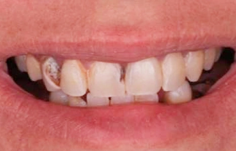 Img-before-and-after - BEFORE 3