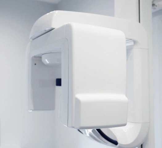 Img-technology-3D Cone Beam Xray