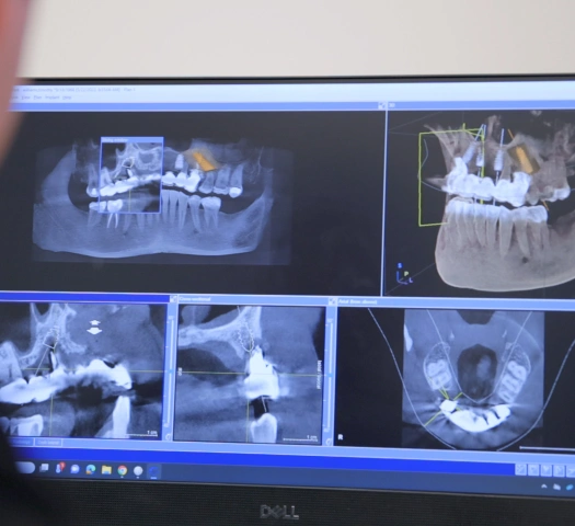 Img-technology-3D Printing Technology