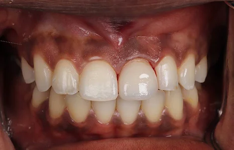 Img-before-and-after - After 16