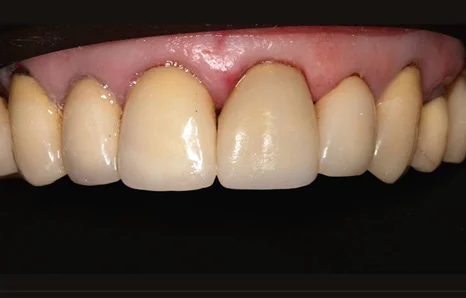 Img-before-and-after - After 17