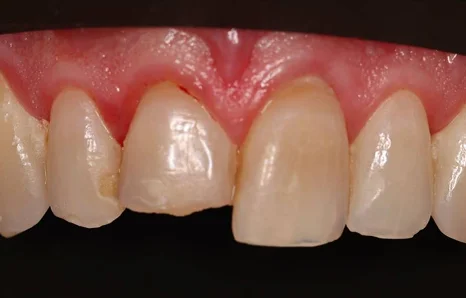 Img-before-and-after - Before 18