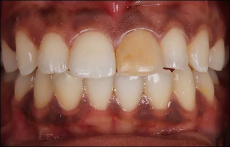 Img-before-and-after - Before 16